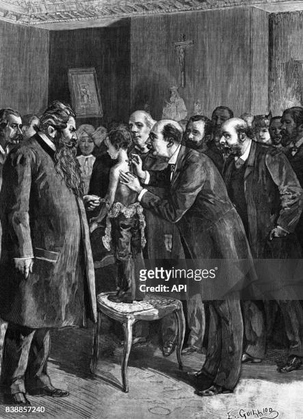 Démonstration d'un traitement de la tuberculose par le docteur Léon Petit, au dispensaire de la rue Miromesnil à Paris, en France, en 1890.