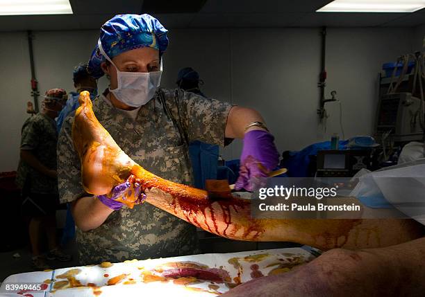 Army Major Norma Kahovec cleans a leg to prepare it for surgery in the operating theatre at the combat support hospital on the U.S military forward...