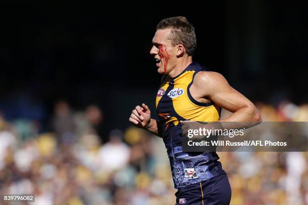 Drew Petrie of the Eagles leaves the field under the blood rule during the round 23 AFL match between the West Coast Eagles and the Adelaide Crows at...