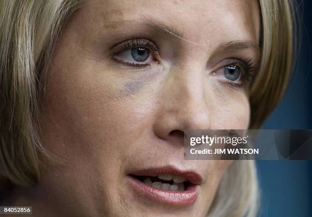 White House Press Secretary Dana Perino speaks during the daily briefing at the White House in Washington, DC, December 16, 2008. Perino was slightly...