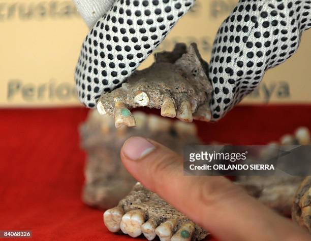 An archaeologist of the Honduran Institute of Anthropology and History examins human jaws inlaid with semiprecious jade stones, dated from the Maya...