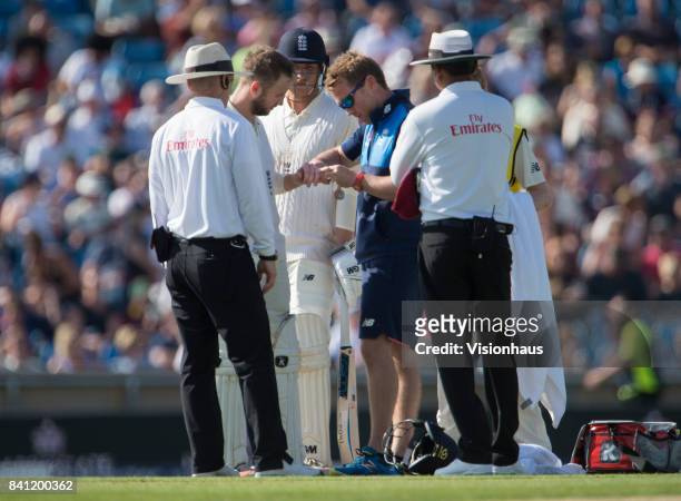 Mark Stoneman of England gets treated for a dislocated finger during the third day of the second test between England and West Indies at Headingley...