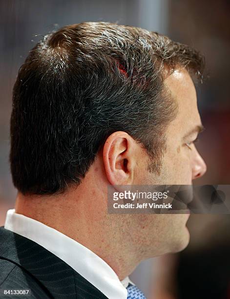 Blood flows from a cut on the head of head coach Alain Vigneault of the Vancouver Canucks after getting hit by a puck during their game against the...