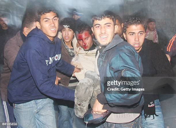 Wounded Palestinian is carried by men after an Israeli missile struck a neighbouring home of Hamas military leader on December 29, 2008 in Beit...
