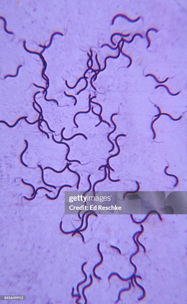 Spiral Bacteria--Spirillum volutans showining bipolar flagella 250X