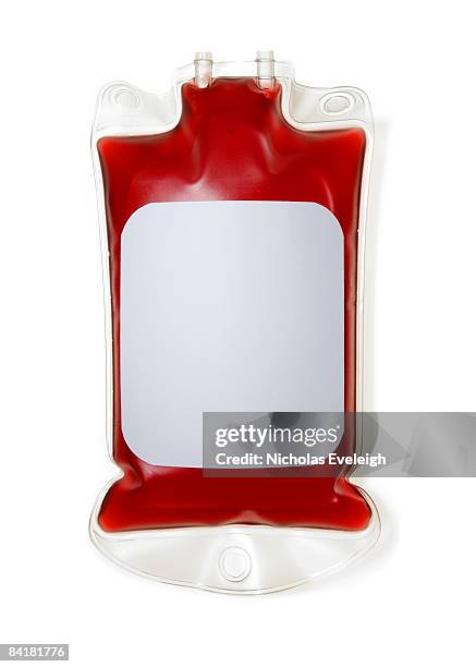 bag of human blood with label - blood bag stock pictures, royalty-free photos & images