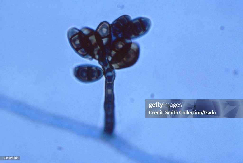 Curvularia Geniculata