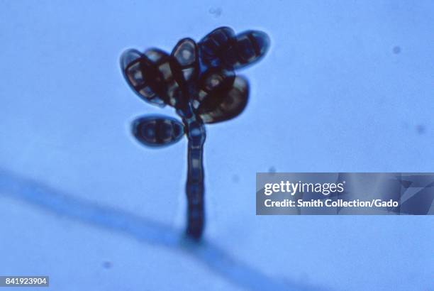 This photomicrograph shows a conidiophore of the fungus Curvularia geniculata, which can be dangerous, and is associated with various human...