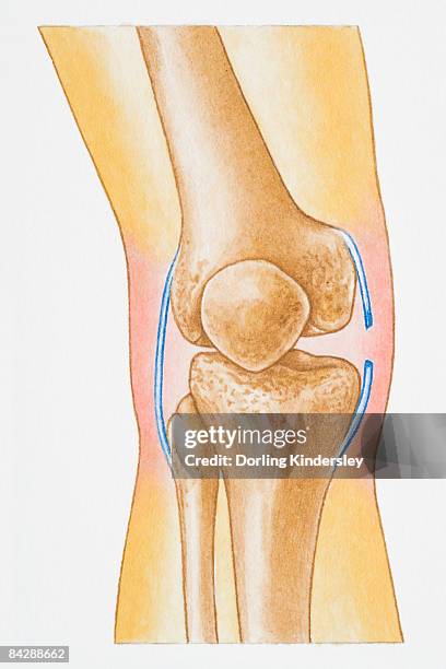 illustration showing torn human knee ligament - torn ligament stock illustrations