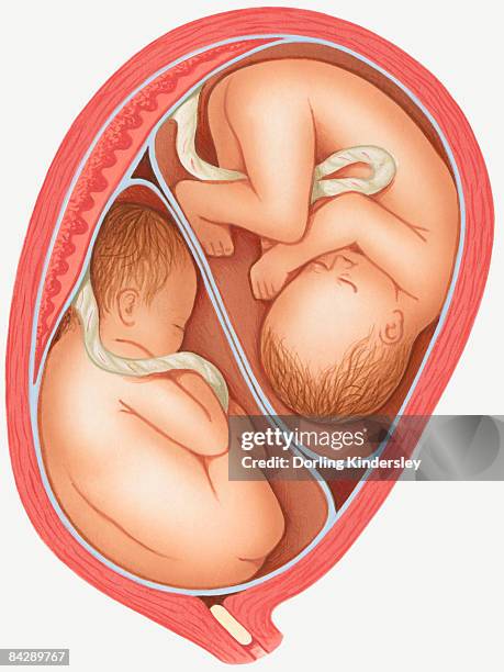 illustration of dizygotic twins in uterus, and mucus plug in cervix - mucus stock illustrations