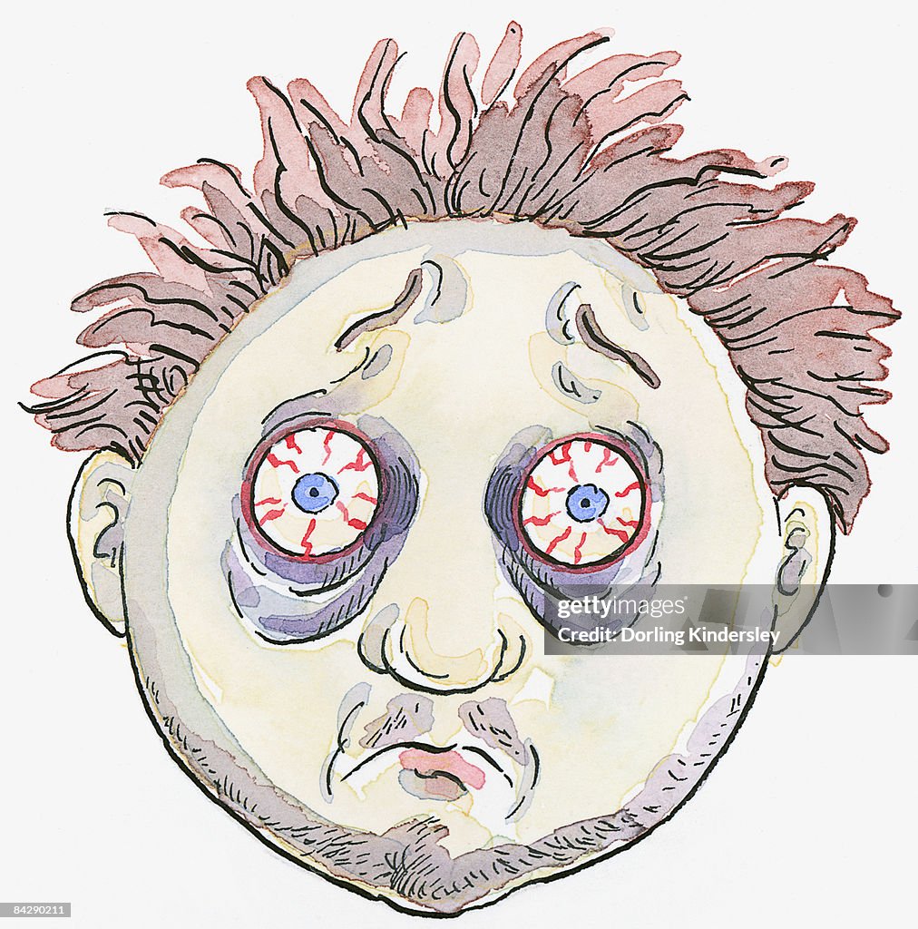 Cartoon of man with messy hair, bags below bloodshot eyes, and stubble on face and chin