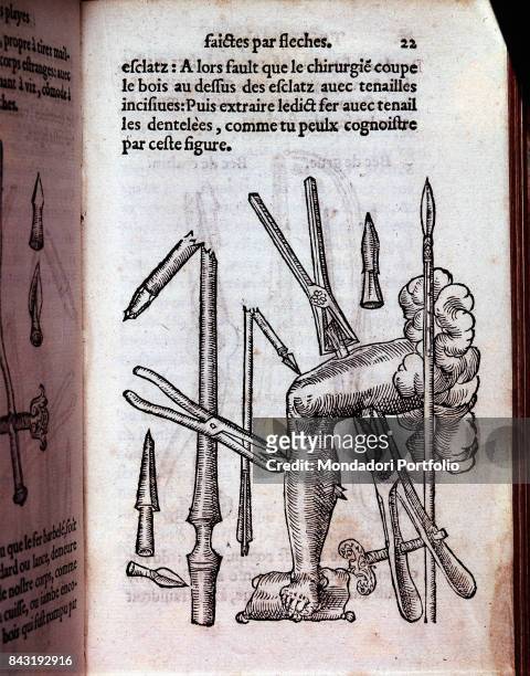 Italy, Lombardy, Milan, Braidense National Library. Whole artwork view. Surgical forceps. Figure from the medical and surgical essay by Ambroise Paré...