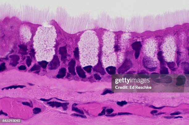 ciliated epithelium--pseudostratified ciliated columnar epithelium with gobiet cells, trachea, 250x - epitelio fotografías e imágenes de stock