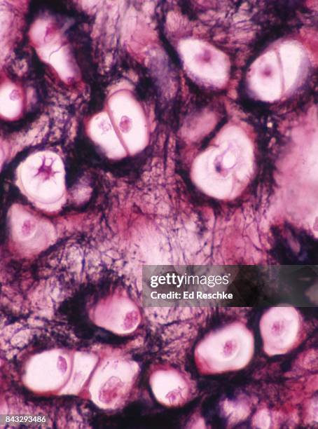 connective tissue--elastic cartilage from human epiglottis, 100x - epiglottis stock pictures, royalty-free photos & images