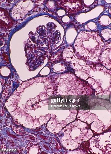 nephron--kidney (human) showing basic structure, 50x - histologia - fotografias e filmes do acervo