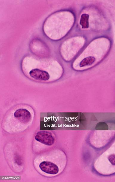 tracheal cartilage--hyaline cartilage, 250x - tracheal cartilage stock pictures, royalty-free photos & images