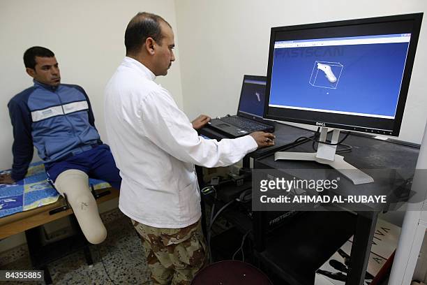 Iraqi soldier Ali Khalid , who lost part of his leg in an improvised explosive device bombing in mid-2007, watches a doctor generate an image of his...