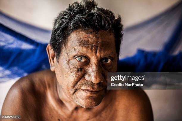 In the Chichigalpa community, an epidemic of Chronic Kidney Disease of unknown origin is now living in the Nicaraguan Pacific Coast. This disease...