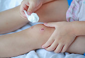 Close Up of child girl dressing wound on knee by self on the bed.