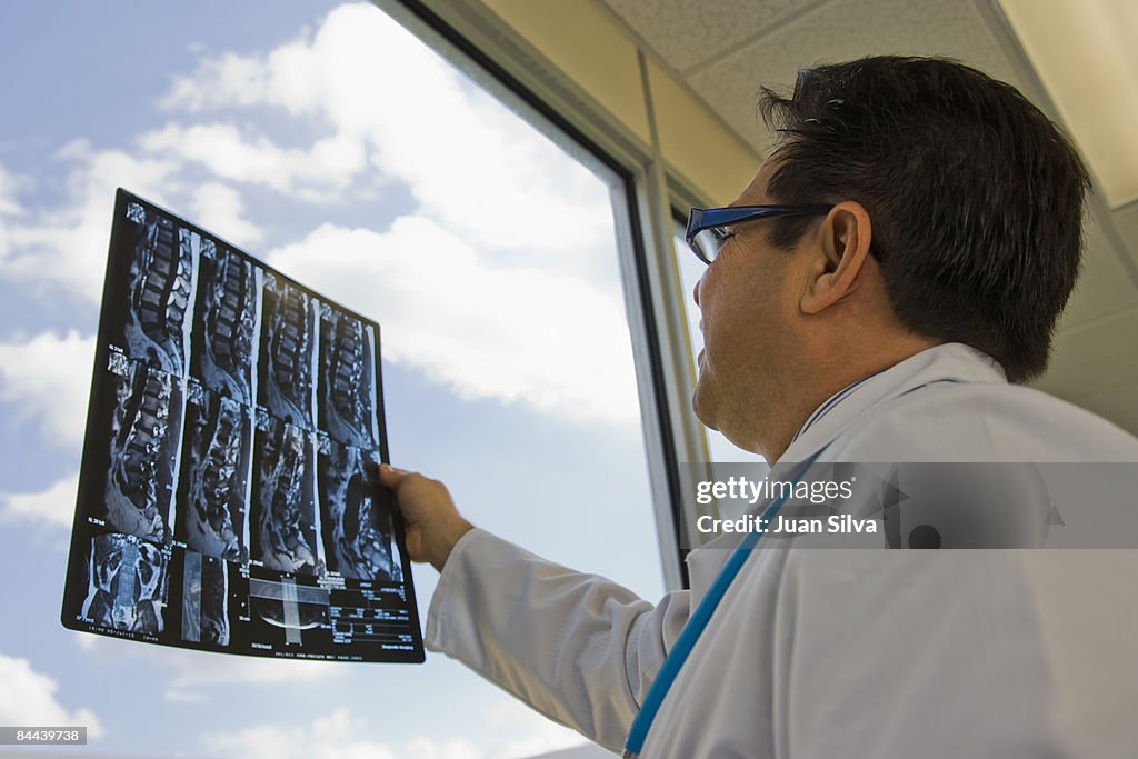 Male doctor looking at  MRI scan