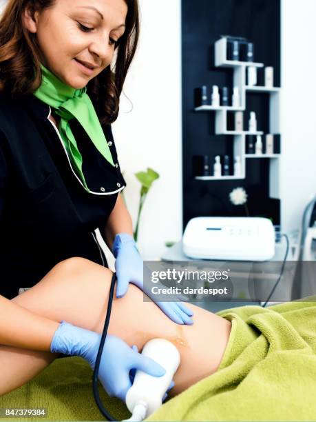 cavitation treatment - calf human leg stock pictures, royalty-free photos & images