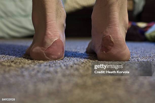 a skier's torn up heels - damaged carpet stock pictures, royalty-free photos & images