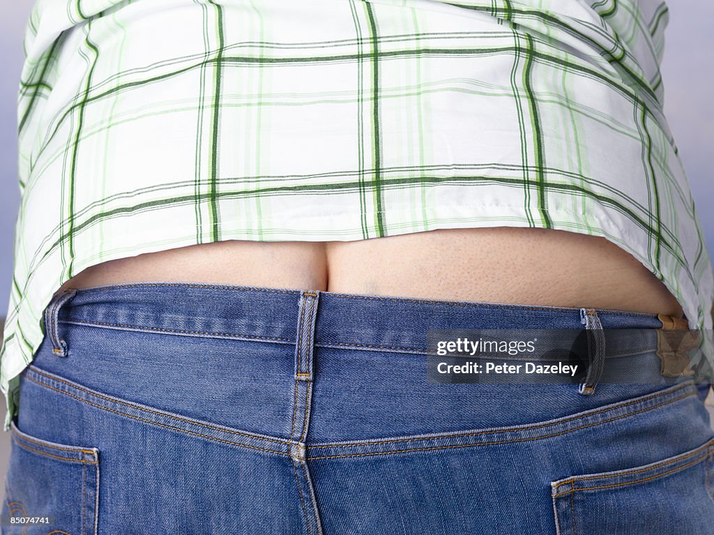 Obese man showing builder's bum.