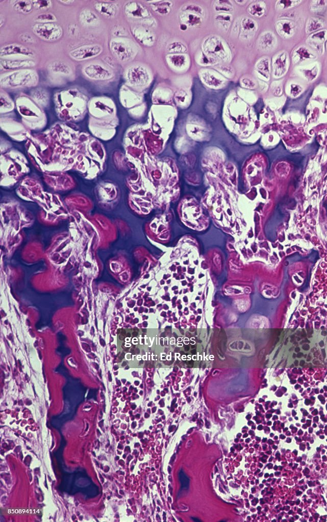Bone Cells--OSTEOBLASTS & OSTEOCYTES, Developing Bone in the Epiphyseal Disk (Growth Plate) of a long bone, 50X