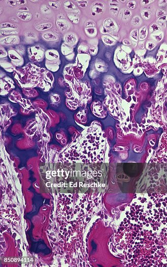 Bone Cells--OSTEOBLASTS & OSTEOCYTES, Developing Bone in the Epiphyseal Disk (Growth Plate) of a long bone, 50X Bone Cells--OSTEOBLASTS & OSTEOCYTES, Developing Bone in the Epiphyseal Disk (Growth Plate) of a long bone, 50X