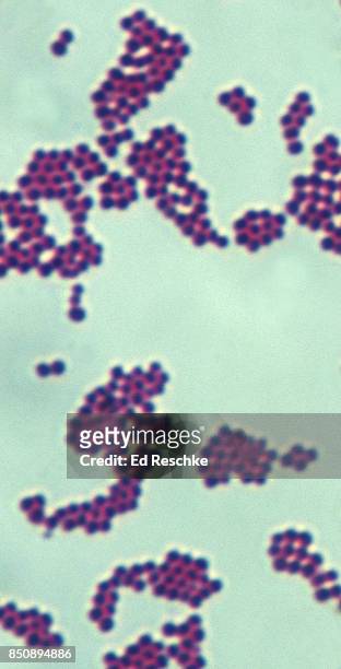 staphylococcus aureus--gram-positive spherical bacteria, 500x - gram positive bacteria 個照片及圖片檔