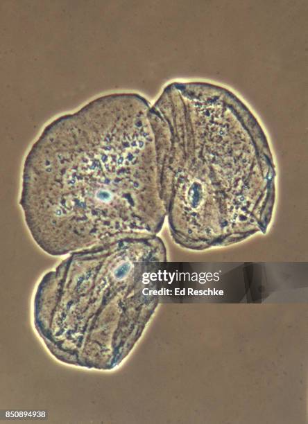 human squamous epithelial cells--dark-field microscopy, 100x - plaveiselcelepitheel stockfoto's en -beelden