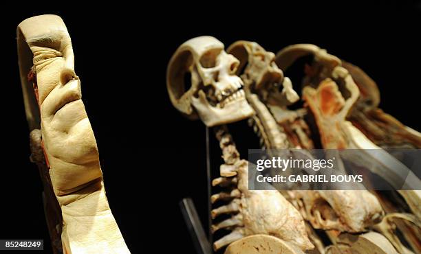 View of Sagittal 3-D slice body on March 4, 2009 at the "Body Worlds", the anatomical exhibition of real human bodies by German Gunther von Hagens to...