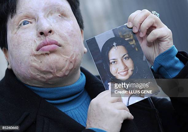 Iranian Ameneh Bahrami poses on March 5, 2009 in Barcelona holding a photograph of herself before she was blinded by a man who threw acid in her...