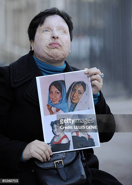 Iranian Ameneh Bahrami poses on March 5, 2009 in Barcelona holding photographs of herself before she was blinded by a man who threw acid in her face....