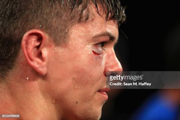 Luke Campbell of Great Britain looks on after being defeated by Jorge Linares of Venezuela in their WBA lightweight title bout at The Forum on...