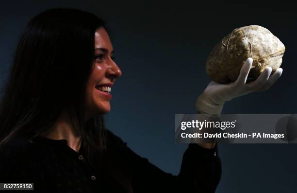 Cast of body snatcher William Burk's brain held by staff member Emma Smith is part of an exhibition of 150 fascinating items from Edinburgh...