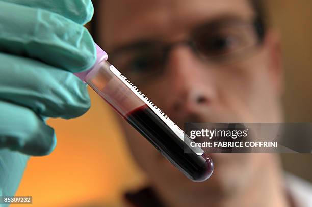 Swiss Laboratory for Doping Analysis' Neil Robinson shows a blood sample in Epalinges near Lausanne on February 25, 2009. The International Cycling...