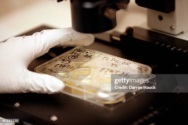 Kejin Hu, a research associate, looks at a colony of human embryonic stem cells under a microscope at the Wisconsin National Primate Research Center...