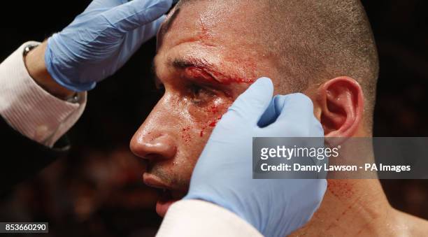 Curtis Woodhouse after being beaten by Willie Limond during the Commonwealth light welterweight title and BBBofC British light welterweight title...