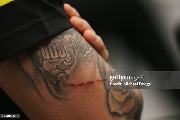 Atatto is seen on the arm of Dustin Martin, a winner of the Brownlow medal last night, as he speaks to media ahead of the Richmond Tigers AFL...