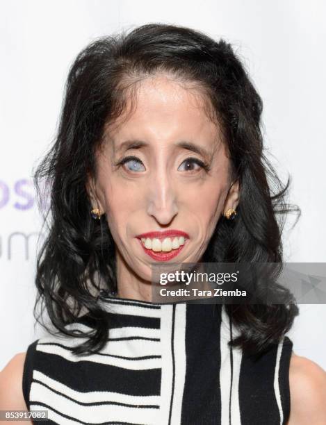 Lizzie Velasquez attends The Purpose Awards at The Conga Room at L.A. Live on September 25, 2017 in Los Angeles, California.