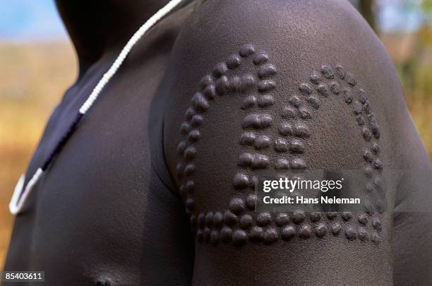 scarring pattern on the shoulder of a mursi boy - mursi tribe stock-fotos und bilder