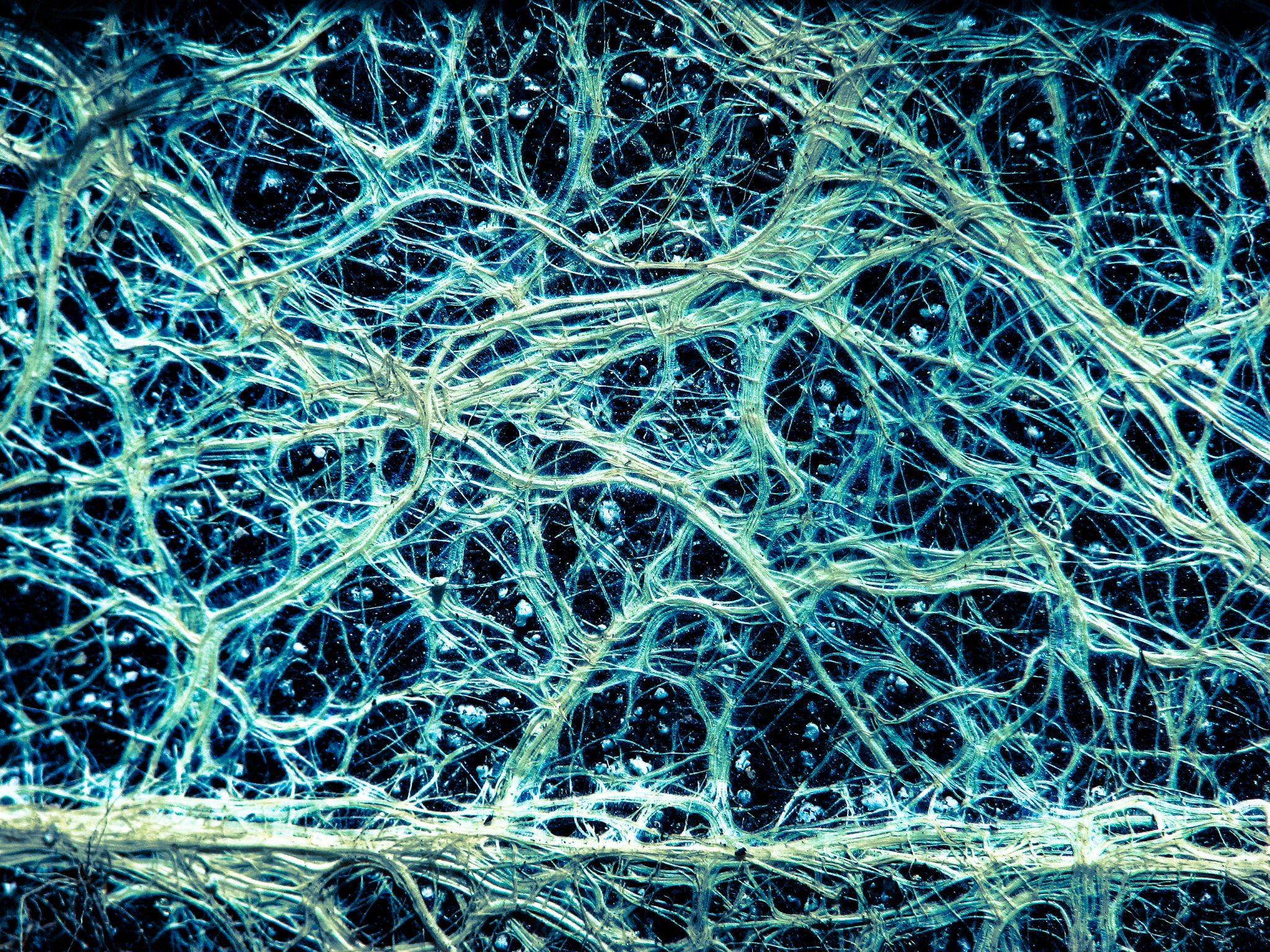 mycorrhizae roots