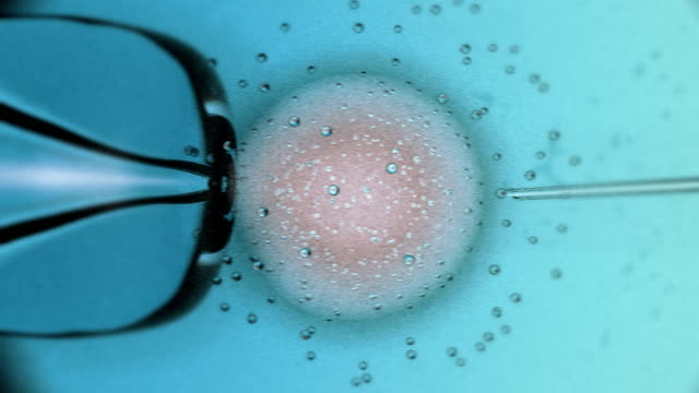 825 Ivf Videos and HD Footage - Getty Images