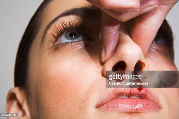 woman pinching bloody nose - pinching nose stockfoto's en -beelden