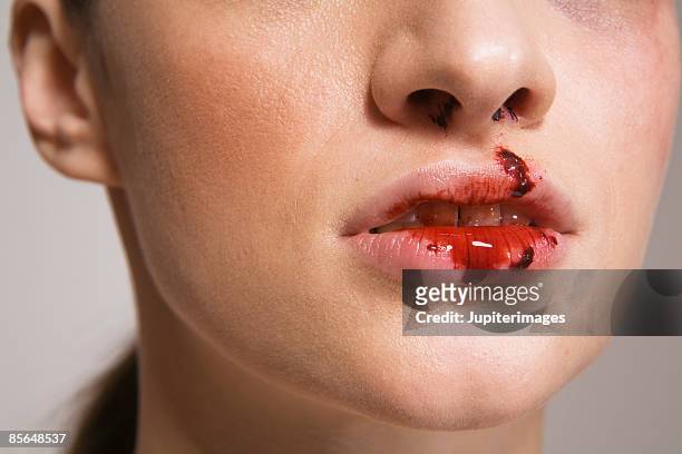 1,966 Bloody Mouth Photos and Premium High Res Pictures - Getty Images