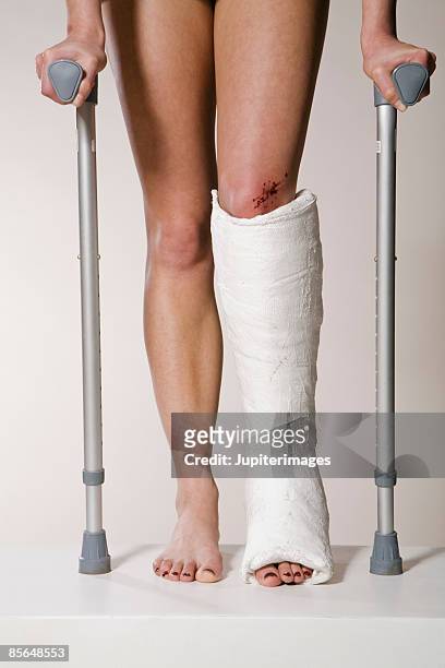 legs of woman with cast and crutches - cast stockfoto's en -beelden