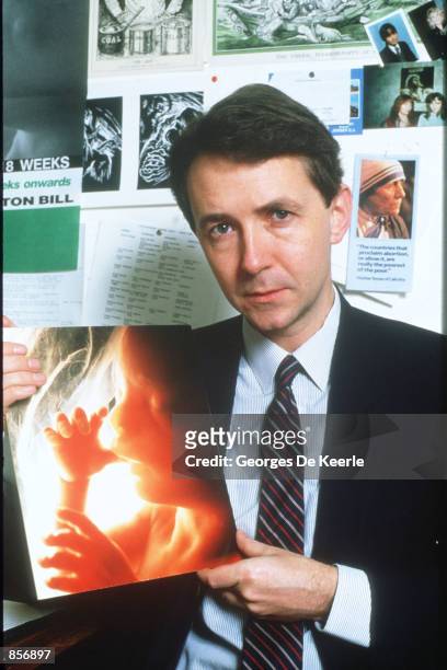 Liberal David Alton holds a picture of a fetus December 3, 1987 in Great Britain. Alton is introducing a new bill to Parliament that would lower the...
