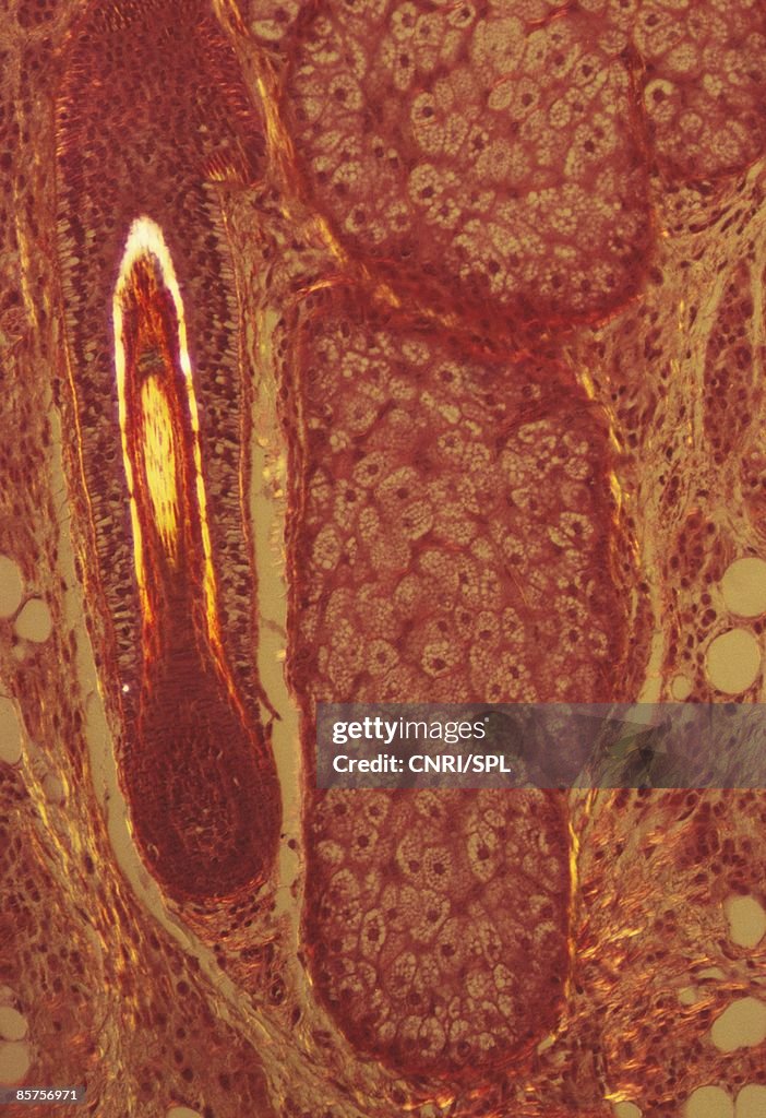 Light micrograph of a section through a hair follicle