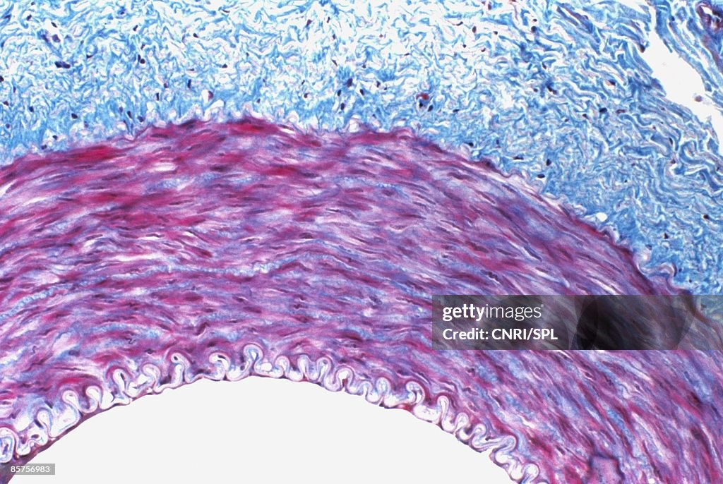 Light micrograph of human artery